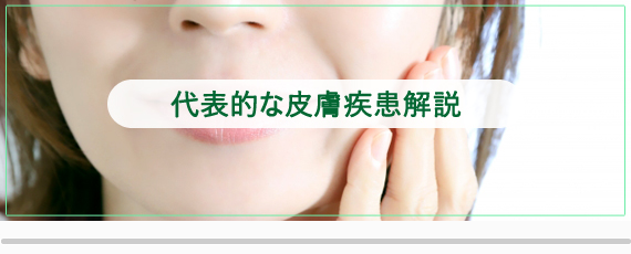 代表的な皮膚疾患解説