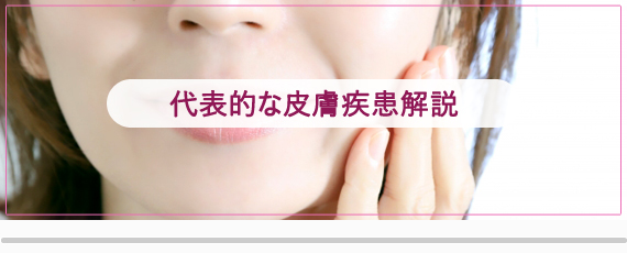 代表的な皮膚疾患解説