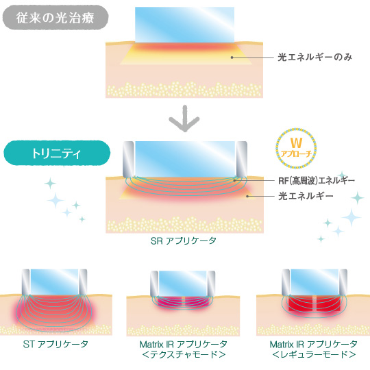 メカニズムイラスト図